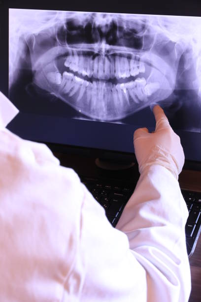Best Emergency Wisdom Teeth Removal in Tsaile, AZ