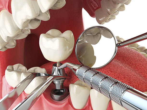 Best Emergency Treatment for Toothache in Tsaile, AZ